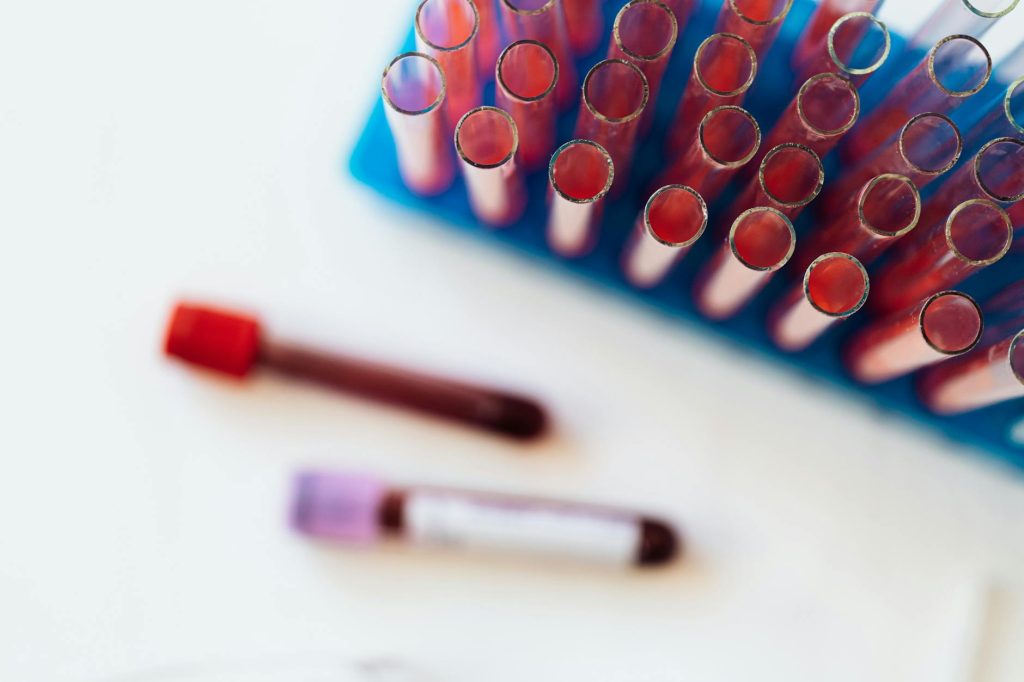 glass tubes with colorful liquids on table